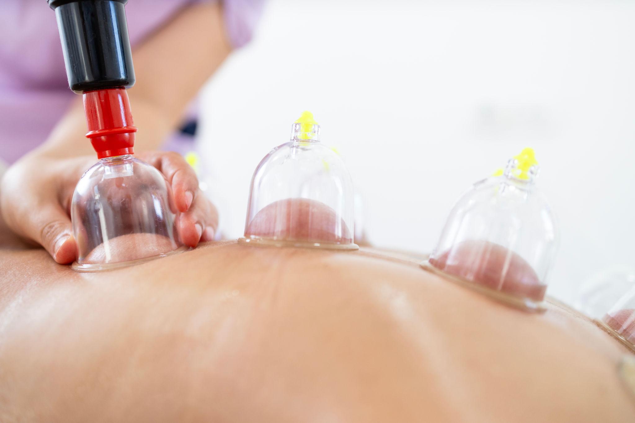 Terapie cu ventuze realizată de specialist FizioLife pentru relaxare musculară și recuperare medicală